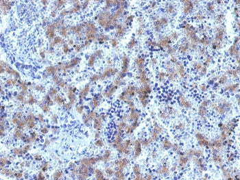 IHC testing of FFPE human fetal liver tissue with recombinant Glypican-3 antibody (clone GPC3/1534R)