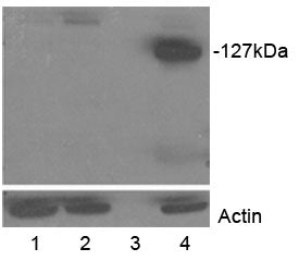 Tankyrase 2 Antibody