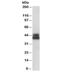 Western blot testing of Jurkat lysate with HLA-B antibody at 0.1ug/ml. Predicted molecular weight: ~