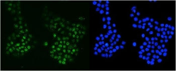 MSH6 Antibody