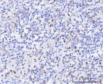 RAD51C Antibody