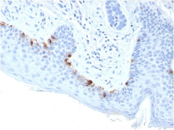 IHC staining of FFPE human skin with TRP1 antibody (clone TYRP1/3283). HIER: boil tissue sections in