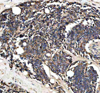 Immunohistochemical staining of PTCD3 using anti-PTCD3 antibody. PTCD3 was detected in a paraffin-em
