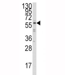 IRF5 Antibody