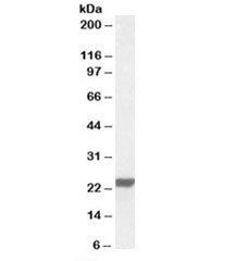 Western blot testing of human lung lysate with HMG4 antibody at 0.01ug/ml. Predicted molecular weigh