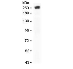 Western blot testing of human Hela cell lysate with recombinant SPTA1 antibody (clone SCNA-1R). Expe