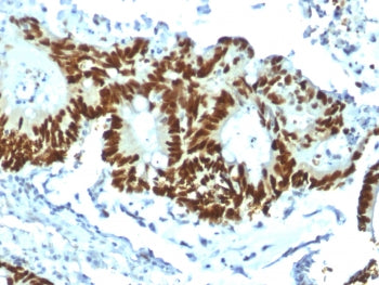 p53 Antibody / TP53