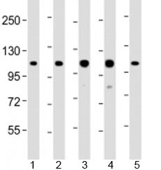 Western blot testing of human 1) HeLa, 2) Jurkat, 3) MOLT-4, 4) CCRF-CEM and 5) DU-145 cell lysate w