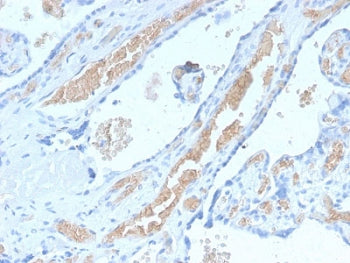 SPTA1 Antibody / Spectrin alpha 1