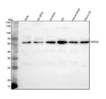 Western blot analysis of NETO2 using anti-NETO2 antibody. Lane 1: human SIHA whole cell lysates, Lan
