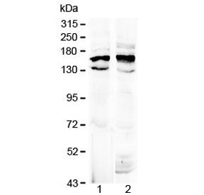 Western blot testing of 1) rat brain and 2) mouse brain lysate with Formin antibody at 0.5ug/ml. Pre