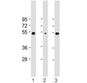 RBCK1 Antibody (UBCE7IP3)
