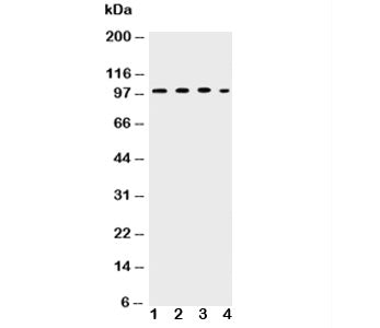 Western blot testing of ICAM-1 antibody and Lane 1: HEPG2; 2: K562; 3: A549; 4: HT1080 lysate. Predi