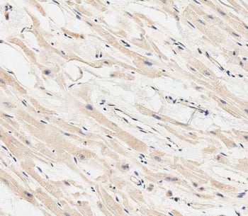 IHC staining of FFPE human heart tissue with MARCH5 antibody. HIER: steam section in pH6 citrate buf