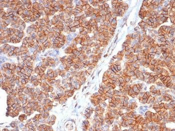 CD99 Antibody / MIC2