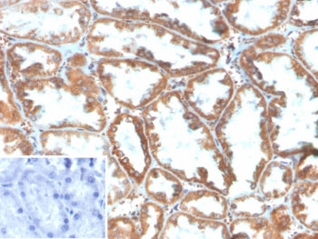 IHC staining of FFPE human kidney tissue with Phospholipase A2 Receptor 1 antibody (clone PLA2R1/489