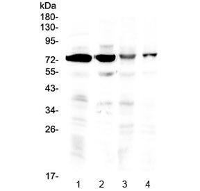 IBSP Antibody / Bone Sialoprotein 2