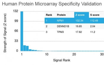 Analysis of HuProt(TM) microarray containing more than 19,000 full-length human proteins using Nucle