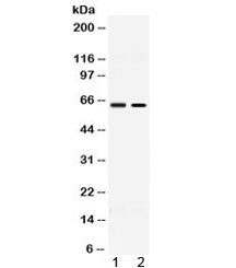 Western blot testing of 1) rat testis and 2) human MCF7 lysate with ACCN1 antibody at 0.5ug/ml. Pred