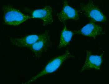 Immunofluorescent staining of FFPE human HeLa cells with Parkinson disease protein 7 antibody (green