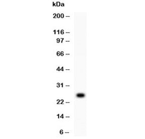 TREM1 Antibody