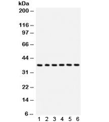 STRAP Antibody