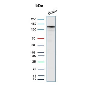 Western blot testing of human brain tissue lysate with HK1 antibody (clone HK1/9506). Predicted mole
