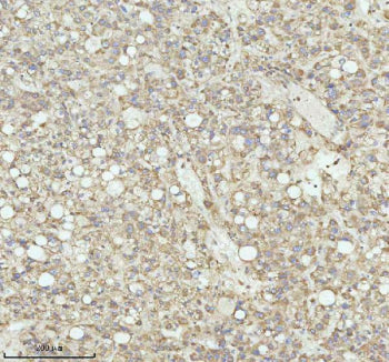 Immunohistochemical staining of NRTN using anti-NRTN antibody. NRTN was detected in a paraffin-embed