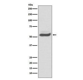 Western blot testing of human fetal kidney lysate with Alpha 1 Antitrypsin antibody. Expected molecu