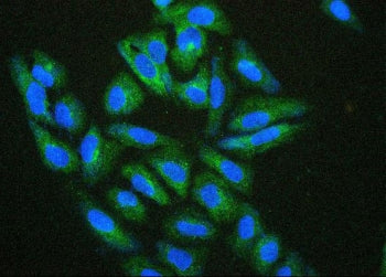 HSP27 Antibody / HSPB1