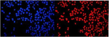 HMGN2 Antibody