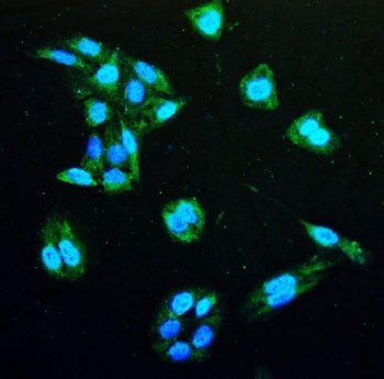 IDH1 Antibody / Isocitrate Dehydrogenase