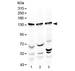 Western blot testing of 1) rat testis, 2) mouse testis and 3) human HeLa lysate with Exportin-5 anti