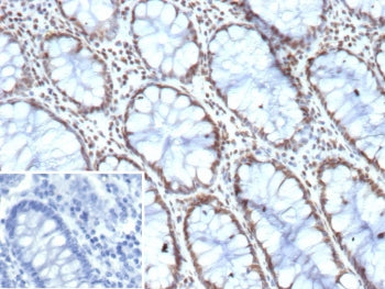 IHC staining of FFPE human colon tissue with HES5 antibody (clone HES5/8035). Inset: PBS used in pla