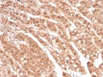 AKR1B1 Antibody / Aldose reductase