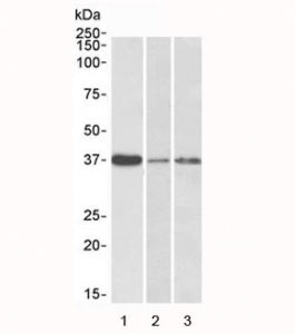 Western blot testing of human 1) liver, 2) skin and 3) tonsil lysate with IL12B antibody at 0.3ug/ml