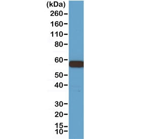 AKT1 Antibody