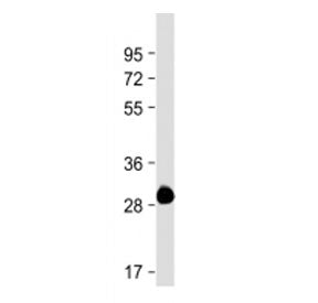 Western blot testing of ROS1 antibody at 1:4000 + partial recombinant protein. Predicted molecular w