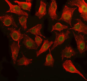 Immunofluorescent staining of OGFOD3 using anti-OGFOD3 antibody (green) and anti-Beta Tubulin antibo