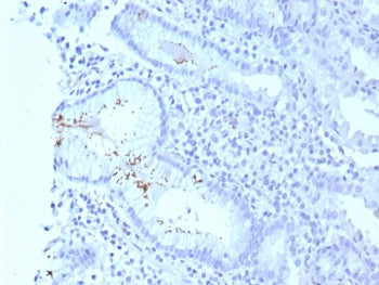 IHC staining of FFPE human H. pylori-infected stomach tissue with H pylori antibody (clone HPYL/8575