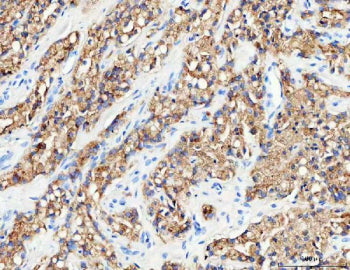 IHC analysis of RAB27B using anti-RAB27B antibody. RAB27B was detected in a paraffin-embedded sectio