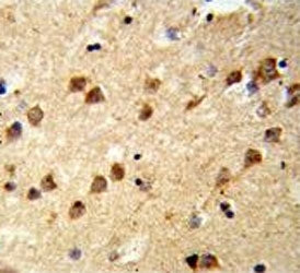 IHC testing of FFPE human brain tissue with Ataxin 3 antibody. HIER: steam section in pH6 citrate bu