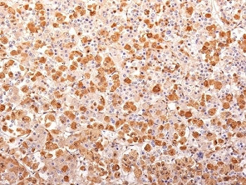 Synacthen Antibody Cocktail / ACTH