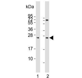 Sclerostin Antibody / SOST