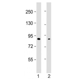 Western blot testing of SMURF2 antibody at 1:2000: Lane 1) human MDA-MB-231 and 2) U-2OS cell lysate
