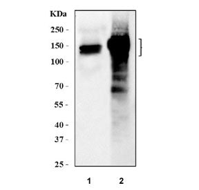 Western blot testing of 1) human PC-3 and 2) mouse lung tissue lysate with AKAP2 antibody at 0.5ug/m
