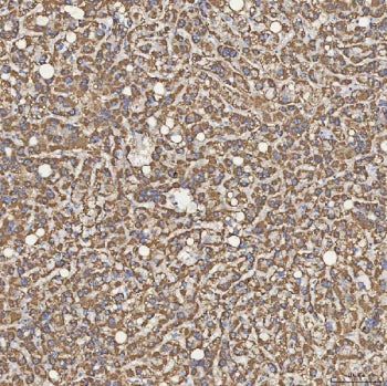 Sideroflexin-5 Antibody / SFXN5