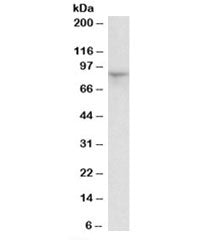 Western blot testing of rat kidney lysate with HCN3 antibody at 1ug/ml. Predicted molecular weight: