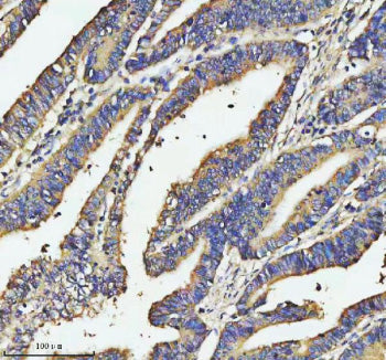 Immunohistochemical staining of SOS1 using anti-SOS1 antibody. SOS1 was detected in a paraffin-embed