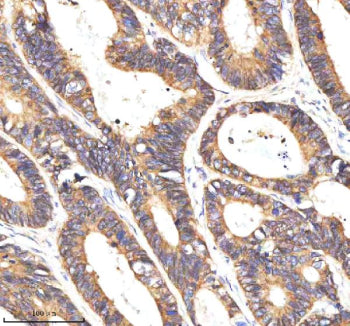 Immunohistochemical staining of NAXE using anti-NAXE antibody. NAXE was detected in a paraffin-embed